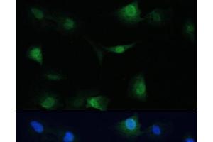 Immunofluorescence analysis of C6 cells using VCP Polyclonal Antibody at dilution of 1:100.