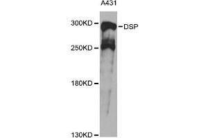 Western blot analysis of extracts of A431 cells, using DSP antibody. (Desmoplakin anticorps)