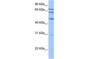 Western Blotting (WB) image for anti-Testis-Specific serine Kinase Substrate (TSKS) antibody (ABIN2463604) (TSKS anticorps)