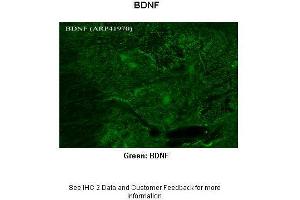 Immunohistochemistry (IHC) image for anti-Brain-Derived Neurotrophic Factor (BDNF) (Middle Region) antibody (ABIN502195) (BDNF anticorps  (Middle Region))
