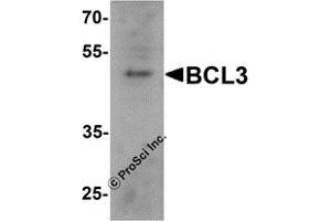 Western Blotting (WB) image for anti-B-Cell CLL/lymphoma 3 (BCL3) (C-Term) antibody (ABIN1077425) (BCL3 anticorps  (C-Term))