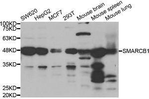 Western blot analysis of extracts of various cell lines, using SMARCB1 antibody. (SMARCB1 anticorps)