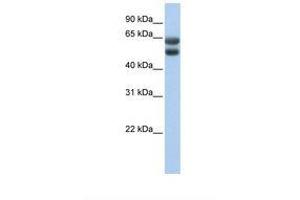 Image no. 1 for anti-Zinc Finger Protein 331 (ZNF331) (AA 51-100) antibody (ABIN6737784) (ZNF331 anticorps  (AA 51-100))