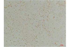 Immunohistochemistry (IHC) analysis of paraffin-embedded Human Colon Tissue using CLIC1 Rabbit Polyclonal Antibody diluted at 1:200. (CLIC1 anticorps)