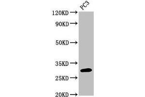 Western Blot Positive WB detected in: PC-3 whole cell lysate All lanes: MRO antibody at 3 μg/mL Secondary Goat polyclonal to rabbit IgG at 1/50000 dilution Predicted band size: 30, 25, 31, 24 kDa Observed band size: 30 kDa (MRO anticorps  (AA 12-85))