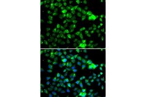 Immunofluorescence analysis of A-549 cells using NAA20 antibody. (NAT5 anticorps  (AA 49-178))