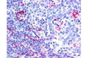 Immunohistochemistry (IHC) image for anti-Neuroepithelial Cell Transforming 1 (NET1) (C-Term) antibody (ABIN2465993) (NET1 anticorps  (C-Term))