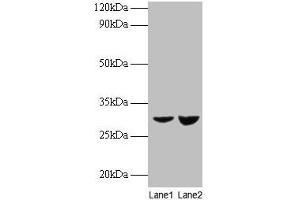 Western blot All lanes: UQCRFS1 antibody at 2 μg/mL Lane 1: EC109 whole cell lysate Lane 2: 293T whole cell lysate Secondary Goat polyclonal to rabbit IgG at 1/15000 dilution Predicted band size: 30 kDa Observed band size: 30 kDa (UQCRFS1 anticorps  (AA 79-274))