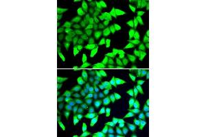 Immunofluorescence analysis of A549 cells using HDAC5 antibody. (HDAC5 anticorps  (AA 350-450))