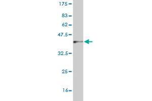 Western Blot detection against Immunogen (37. (CNDP2 anticorps  (AA 191-300))