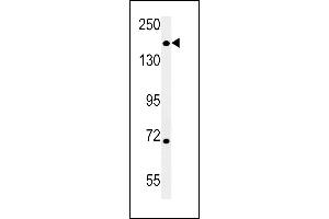 DI3L1 Antibody (N-term) (ABIN651802 and ABIN2840405) western blot analysis in mouse heart tissue lysates (15 μg/lane). (DIS3L anticorps  (N-Term))
