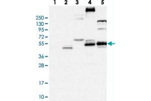 Western blot analysis of Lane 1: RT-4, Lane 2: U-251 MG, Lane 3: Human Plasma, Lane 4: Liver, Lane 5: Tonsil with FLVCR2 polyclonal antibody . (FLVCR2 anticorps)