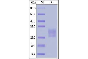 Frizzled Family Receptor 7 (FZD7) (AA 33-185) protein (His tag)