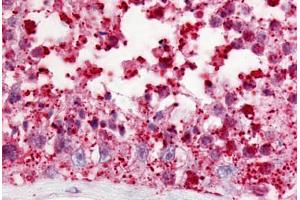 Human Testis (formalin-fixed, paraffin-embedded) stained with GPR18 antibody ABIN213636 at 10 ug/ml followed by biotinylated goat anti-rabbit IgG secondary antibody ABIN481713, alkaline phosphatase-streptavidin and chromogen.