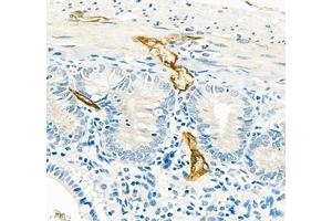 Immunohistochemistry of paraffin embedded rat colon using MADCAM1 (ABIN7074695) at dilution of 1:3400 (400x lens) (MADCAM1 anticorps)