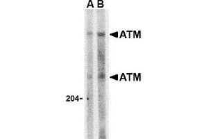 Western Blotting (WB) image for anti-Ataxia Telangiectasia Mutated (ATM) (C-Term) antibody (ABIN1030266) (ATM anticorps  (C-Term))