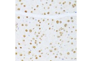 Immunohistochemistry of paraffin-embedded mouse pancreas using ETV1 antibody (ABIN6129794, ABIN6140327, ABIN6140329 and ABIN6217250) at dilution of 1:100 (40x lens). (ETV1 anticorps  (AA 80-300))