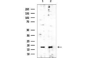 anti-Ribosomal Protein L24 (RPL24) (Internal Region) antibody