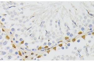 Immunohistochemistry of paraffin-embedded Rat testis using ELAC2 Polyclonal Antibody at dilution of 1:200 (40x lens). (ELAC2 anticorps)