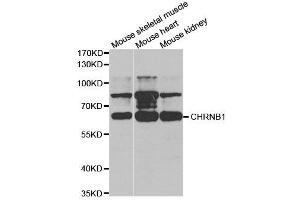 Western Blotting (WB) image for anti-Nicotinic Acetylcholine Receptor beta (CHRNB1) antibody (ABIN1876483) (CHRNB1 anticorps)