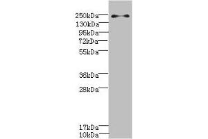 Western blot All lanes: PLA2R1 antibody IgG at 0. (PLA2R1 anticorps  (AA 870-1130))