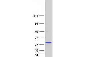 Transgelin 3 (TAGLN3) (Transcript Variant 3) protein (Myc-DYKDDDDK Tag)
