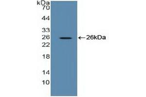 Detection of Recombinant EEF2, Human using Polyclonal Antibody to Eukaryotic Translation Elongation Factor 2 (EEF2) (EEF2 anticorps  (AA 32-233))