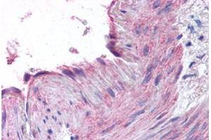 Immunohistochemical staining of human small intestine, vessel with CCR1 polyclonal antibody .