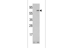 Western blot analysis of lysate from human placenta tissue lysate, using M-CSF Antibody at 1:1000 at each lane. (M-CSF/CSF1 anticorps  (AA 230-257))