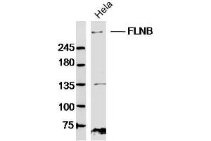 Hela lysates probed with FLNB Polyclonal Antibody, Unconjugated  at 1:300 dilution and 4˚C overnight incubation. (FLNB anticorps  (AA 1551-1650))