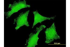 Immunofluorescence of monoclonal antibody to DND1 on HeLa cell. (DND1 anticorps  (AA 167-260))