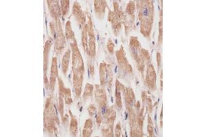 (ABIN6242162 and ABIN6577231) staining KANK1 in human heart tissue sections by Immunohistochemistry (IHC-P - paraformaldehyde-fixed, paraffin-embedded sections).