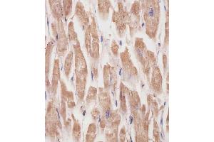(ABIN6242162 and ABIN6577231) staining KANK1 in human heart tissue sections by Immunohistochemistry (IHC-P - paraformaldehyde-fixed, paraffin-embedded sections). (ANKRD15 anticorps)