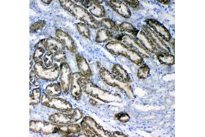 IHC analysis of Glycerol kinase using anti-Glycerol kinase antibody .
