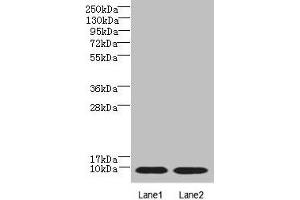Western blot All lanes: NOP10 antibody at 4 μg/mL Lane 1: Jurkat whole cell lysate Lane 2: Caco-2 whole cell lysate Secondary Goat polyclonal to rabbit IgG at 1/10000 dilution Predicted band size: 8 kDa Observed band size: 8 kDa (rRNA 2'-O-Methyltransferase Fibrillarin (FBL) (AA 1-64) anticorps)