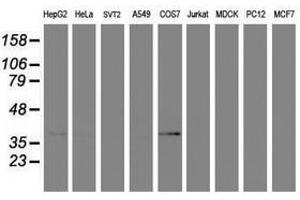 Image no. 4 for anti-Prenyl (Decaprenyl) Diphosphate Synthase, Subunit 2 (PDSS2) antibody (ABIN1500138)