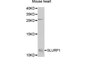 Western blot analysis of extracts of Mouse heart cells, using SLURP1 antibody. (SLURP1 anticorps)