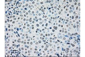 Image no. 3 for anti-B-Raf proto-oncogene, serine/threonine kinase (BRAF) antibody (ABIN1496951)