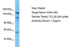 Host: Rabbit Target Name: KIAA1462 Sample Type: 721_B Whole Cell lysates Antibody Dilution: 1. (JCAD/KIAA1462 anticorps  (N-Term))