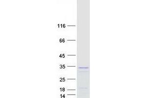 Validation with Western Blot