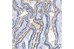 Immunohistochemical staining (Formalin-fixed paraffin-embedded sections) of human duodenum with DLC1 polyclonal antibody  shows distinct positivity of microvilli in glandular cells. (DLC1 anticorps)