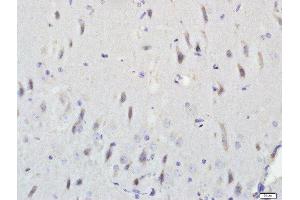 Paraformaldehyde-fixed, paraffin embedded rat brain, Antigen retrieval by boiling in sodium citrate buffer (pH6.