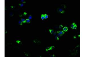 Immunofluorescence staining of PC-3 cells with ABIN7173843 at 1:133, counter-stained with DAPI.