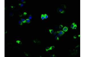 Immunofluorescence staining of PC-3 cells with ABIN7173843 at 1:133, counter-stained with DAPI. (TNFRSF11A anticorps  (AA 28-202))