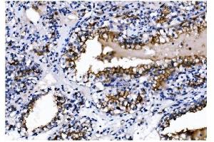IHC analysis of CD13/ANPEP using anti-CD13/ANPEP antibody (ABIN7600088). (CD13 anticorps  (AA 148-966))