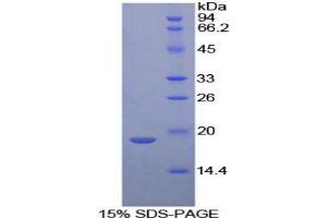 SDS-PAGE analysis of Mouse Neurotensin Protein. (Neurotensin Protein (NTS))