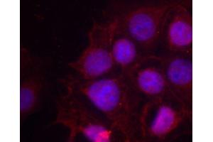 Immunofluorescence staining of methanol-fixed MCF-7 cells using Phospho-ESR1-S118 antibody (ABIN2987431). (Estrogen Receptor alpha anticorps  (pSer118))