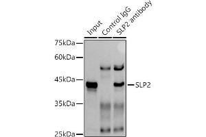 Immunoprecipitation analysis of 300 μg extracts of A-549 cells using 3 μg SLP2 antibody (ABIN7270675).