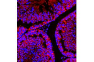 Immunofluorescence of paraffin embedded mouse testis using SRP14 (ABIN7075596) at dilution of 1:300 (400x lens)