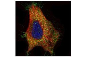 ICC/IF Image Confocal immunofluorescence analysis (Olympus FV10i) of paraformaldehyde-fixed HeLa, using GAD65, antibody (Green) at 1:500 dilution.